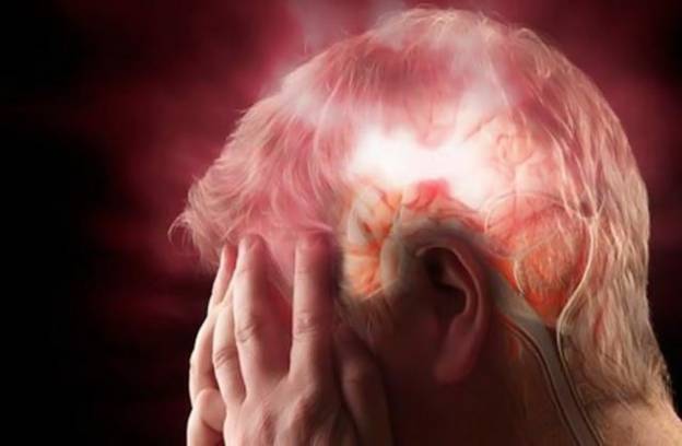 Εγκεφαλικό: Τα συμπτώματα που δεν πρέπει να αγνοήσετε