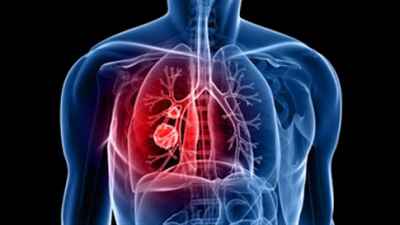 Όλα όσα πρέπει να γνωρίζoυμε για το άσθμα και την αντιμετώπισή του.