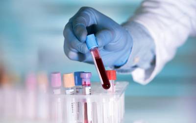 Τεστ αίματος ανιχνεύει 10 τύπους καρκίνου, χρόνια πριν εκδηλωθούν
