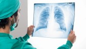 Υποτροπή καρκίνου πνεύμονα: O ειδικός απαντά στις απορίες μας