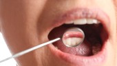 Καρκίνος του στόματος: Πώς μπορεί ο οδοντίατρος να συμβάλει στην έγκαιρη διάγνωση;