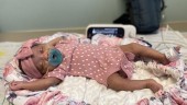 Παγκόσμια καινοτομία: Για πρώτη φορά ενδομήτρια εγχείρηση στον εγκέφαλο εμβρύου που έπασχε από σπάνια πάθηση