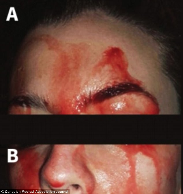 4599B27100000578-5008295-Doctors in Florence Italy describe the case of a young women wit-a-30 1508758621451