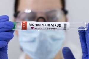 Ευλογιά των πιθήκων: Συνολικά 7 κρούσματα στην Ελλάδα – Διερεύνηση για εγχώρια μετάδοση