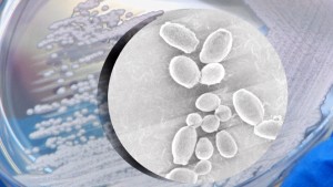 Candida Auris στα νοσοκομεία: Ποια είναι η κατάσταση στη χώρα
