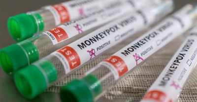 Η ευλογιά των πιθήκων μπορεί να προκαλέσει και σοβαρές νευρολογικές επιπλοκές