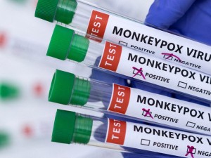 Ευλογιά των πιθήκων: Σε 50 ανέρχονται τα επιβεβαιωμένα κρούσματα στη χώρα
