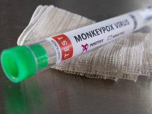 Ευλογιά των πιθήκων: Στα 54 τα κρούσματα στην Ελλάδα