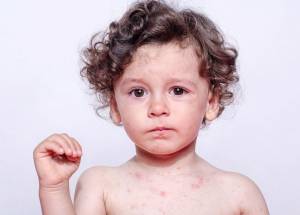 Εγκύκλιο για τον υποχρεωτικό εμβολιασμό των παιδιών ζητά ο Συνήγορος του Πολίτη