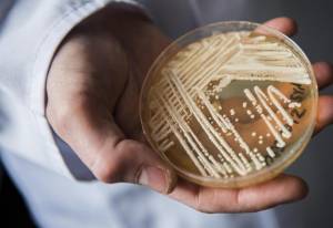 Συναγερμός και στην Ελλάδα για το μύκητα candida auris που σκορπά το θάνατο