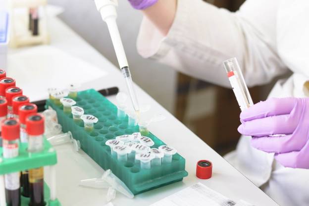 Τσιόδρας: Σε 3 μήνες τα πρώτα αποτελέσματα για το εμβόλιο του κοροναϊού