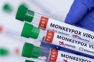 Ευλογιά των πιθήκων: 69 τα κρούσματα στη χώρα μας