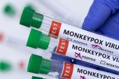 Ευλογιά των πιθήκων: 69 τα κρούσματα στη χώρα μας