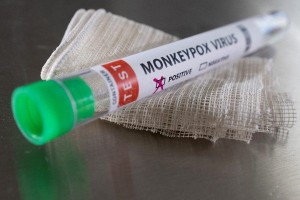 Ευλογιά των πιθήκων: Ύποπτο κρούσμα στη Νάξο