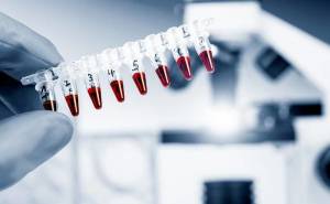 Μια ακόμα ιδιωτική Τράπεζα φύλαξης βλαστοκυττάρων χωρίς άδεια στα χέρια του εισαγγελέα