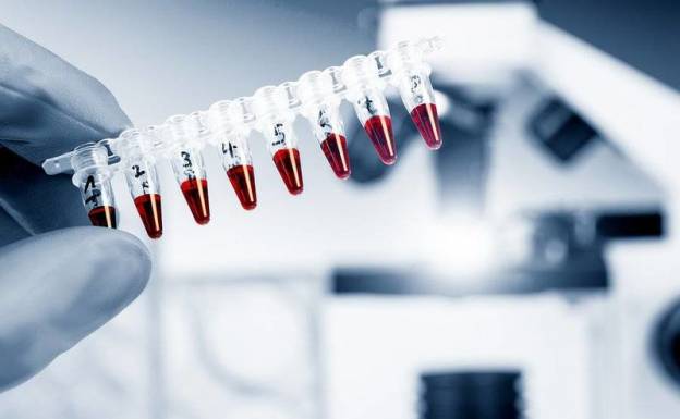 Μια ακόμα ιδιωτική Τράπεζα φύλαξης βλαστοκυττάρων χωρίς άδεια στα χέρια του εισαγγελέα