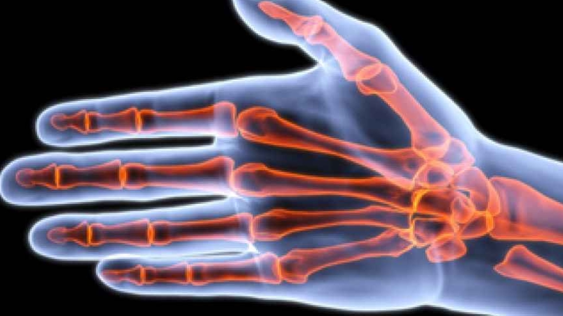 Αρθροσκοπική Χειρουργική του Καρπού