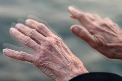 Επιτυχία Ελληνα επιστήμονα: Ανακάλυψε τις πιο πρώιμες ενδείξεις Πάρκινσον στον εγκέφαλο