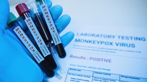 Κατάσταση έκτακτης ανάγκης στις ΗΠΑ για την ευλογιά των πιθήκων