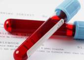 Hello Haemophilia: Μία κοινότητα με στόχο τη θετική αλλαγή για τους ανθρώπους με αιμορροφιλία και στην Ελλάδα
