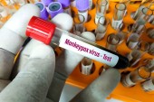 Στα 72 τα επιβεβαιωμένα κρουσμάτα της ευλογιάς των πιθήκων
