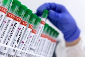Ευλογιά των πιθήκων: Ο ΠΟΥ κύρηξε παγκόσμιο συναγερμό