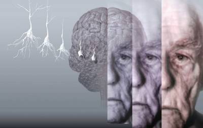 Οι επιστήμονες ανακοίνωσαν πως βρίσκονται μια ανάσα από την ανακάλυψη φαρμάκου για το Αλτσχάιμερ