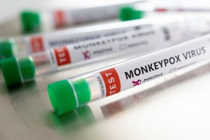 Ευλογιά των πιθήκων: Πάνω από 80 τα καταγεγραμμένα κρούσματα στη χώρα
