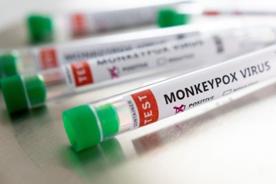Ευλογιά των πιθήκων: Πάνω από 80 τα καταγεγραμμένα κρούσματα στη χώρα