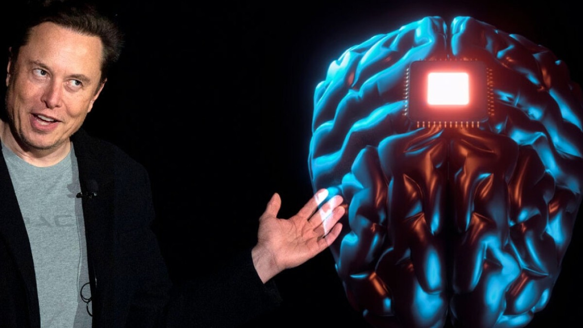 Εταιρεία του Έλον Μασκ ανακοίνωσε την πρώτη επιτυχή εμφύτευση τσιπ σε εγκέφαλο ασθενή